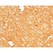 Neuron-Specific Enolase